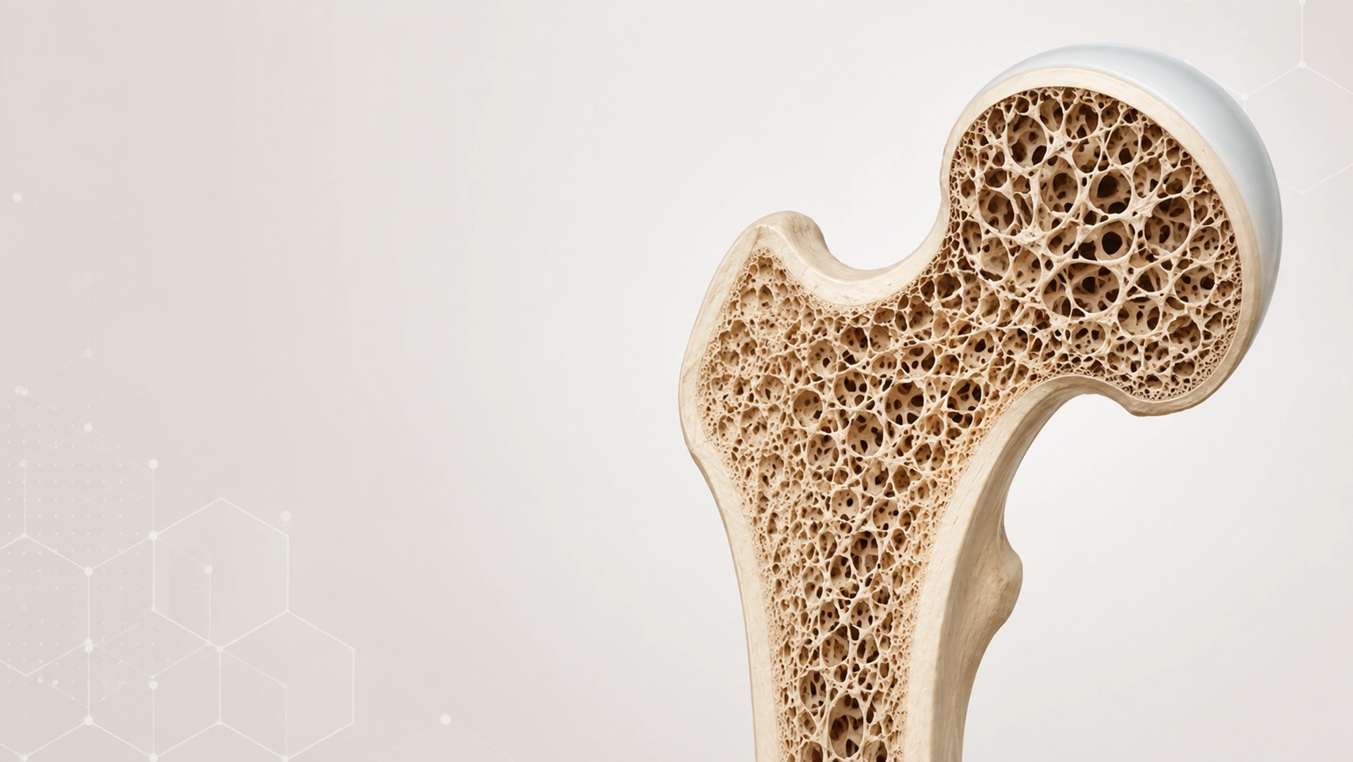 Jornada clínica osteoporosis - profesionales
